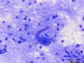 Purkinje cells and capillaries (cerebellum)