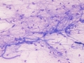 Axons