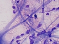 Axons, oligodendroglia & myelin