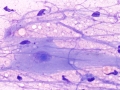 Neurone