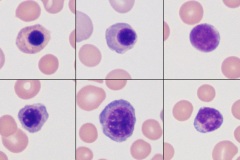 Nucleated RBC