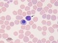 Metarubricyte & lymph (dog)