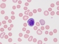 Basophilic rubricyte (dog)