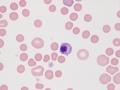 Metarubricyte (dog)