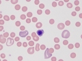 Metarubricyte (dog)