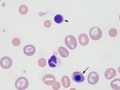 Metarubricyte & lymph (dog)