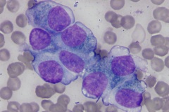 Oropharynx