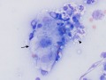 Mycoplasma