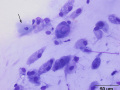 Salivary granuloma (cat)