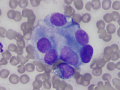 Melanoma (rapid stain)