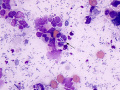 Septic inflammation