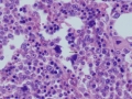 Histiocytic sarcoma (dog, H&E)