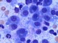 Multiple myeloma (dog)