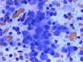 Multiple myeloma (dog)