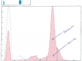 Multiple myeloma: ELP (dog)