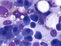 Multiple myeloma (dog)