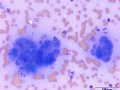 Inflammation