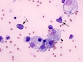 Lymphoma (cat)