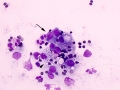 Lymphoma (cat, DQ)