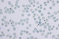 Porcine blood