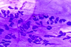 Porcupine cytology