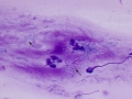 Non-staining bacilli (DQ)