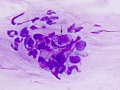 Candida (DQ)