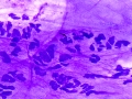 Candida (DQ)