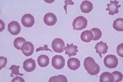 RBC morphology