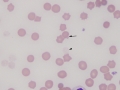 Heinz bodies, pyknocytes & ghost (horse)