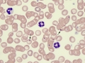 Howell-jolly bodies (dog)