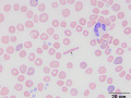 Hemoglobin crystal
