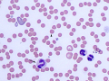 Spherocytes