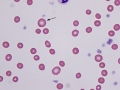 Macrocyte (dog)