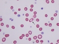 Elliptocyte (dog)