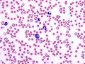 Spherocytes (dog)