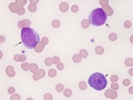Dysplastic RBC (cat)