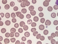 Target cells