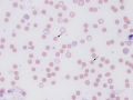 Spherocytes (dog)