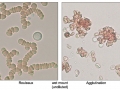 Agglutination vs rouleaux