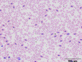 Mixture of RBCs