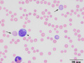 Polychromatophil & spherocytes (calf)