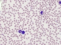 Poikilocytes (calf)