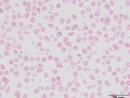 Hypochromasia (bovine)