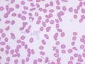 Poikilocytosis (cat)