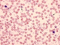 Hypochromasia (coyote)