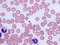 Eccentrocyte
