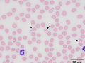 Echinocytes
