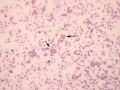 Agglutination (horse)