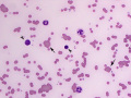 Agglutination (horse)